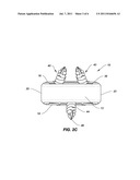 SPINAL IMPLANT CONFIGURED FOR MIDLINE INSERTION diagram and image