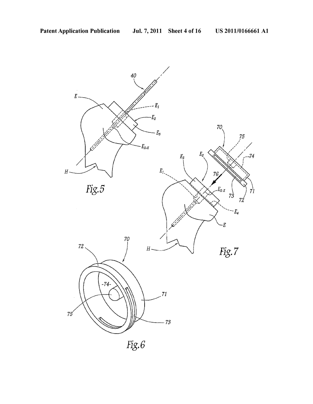 APPARATUS FOR FITTING A SHOULDER PROSTHESIS - diagram, schematic, and image 05