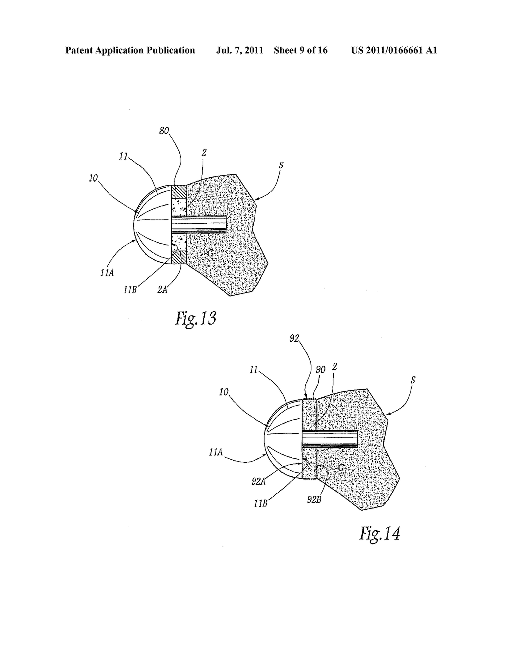 APPARATUS FOR FITTING A SHOULDER PROSTHESIS - diagram, schematic, and image 10