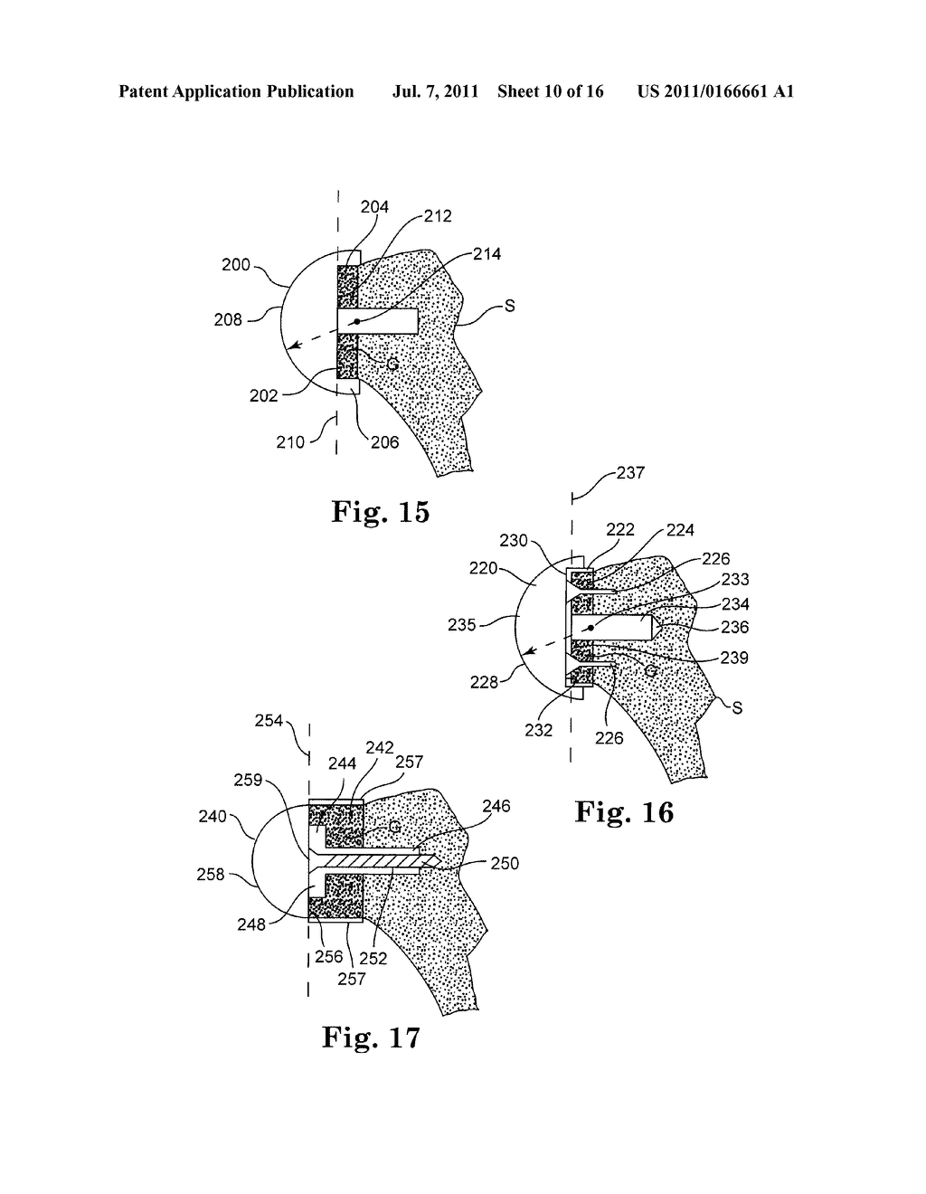 APPARATUS FOR FITTING A SHOULDER PROSTHESIS - diagram, schematic, and image 11