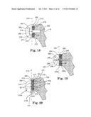 APPARATUS FOR FITTING A SHOULDER PROSTHESIS diagram and image