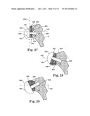 APPARATUS FOR FITTING A SHOULDER PROSTHESIS diagram and image