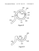 LATERAL ELBOW PROSTHESIS - PROXIMAL RADIOULNAR JOINT diagram and image