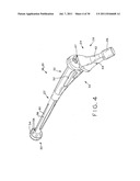 PROSTHETIC HIP IMPLANTS diagram and image