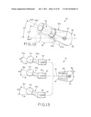 PROSTHETIC HIP IMPLANTS diagram and image