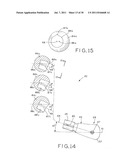 PROSTHETIC HIP IMPLANTS diagram and image