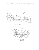 PROSTHETIC HIP IMPLANTS diagram and image