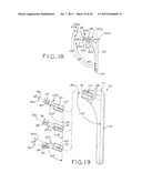 PROSTHETIC HIP IMPLANTS diagram and image