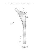 PROSTHETIC HIP IMPLANTS diagram and image