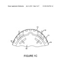 HELMET COMPRISING SURFACE REINFORCING COMPONENT WITH EMBEDDED ANCHORS diagram and image