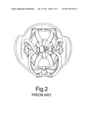 HELMET FITTING AND IMPACT ATTENUATION SYSTEM diagram and image