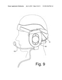 HELMET FITTING AND IMPACT ATTENUATION SYSTEM diagram and image