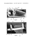 SUPPORT SURFACE ASSEMBLY AND TENSIONING METHOD FOR A SLEEPING PERSON diagram and image