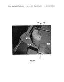 SUPPORT SURFACE ASSEMBLY AND TENSIONING METHOD FOR A SLEEPING PERSON diagram and image