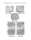 IMMUNONEUTRAL SILK-FIBER-BASED MEDICAL DEVICES diagram and image