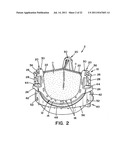 VALVE ASSEMBLY WITH EXCHANGEABLE VALVE MEMBER AND A TOOL SET FOR     EXCHANGING THE VALVE MEMBER diagram and image