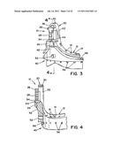 VALVE ASSEMBLY WITH EXCHANGEABLE VALVE MEMBER AND A TOOL SET FOR     EXCHANGING THE VALVE MEMBER diagram and image