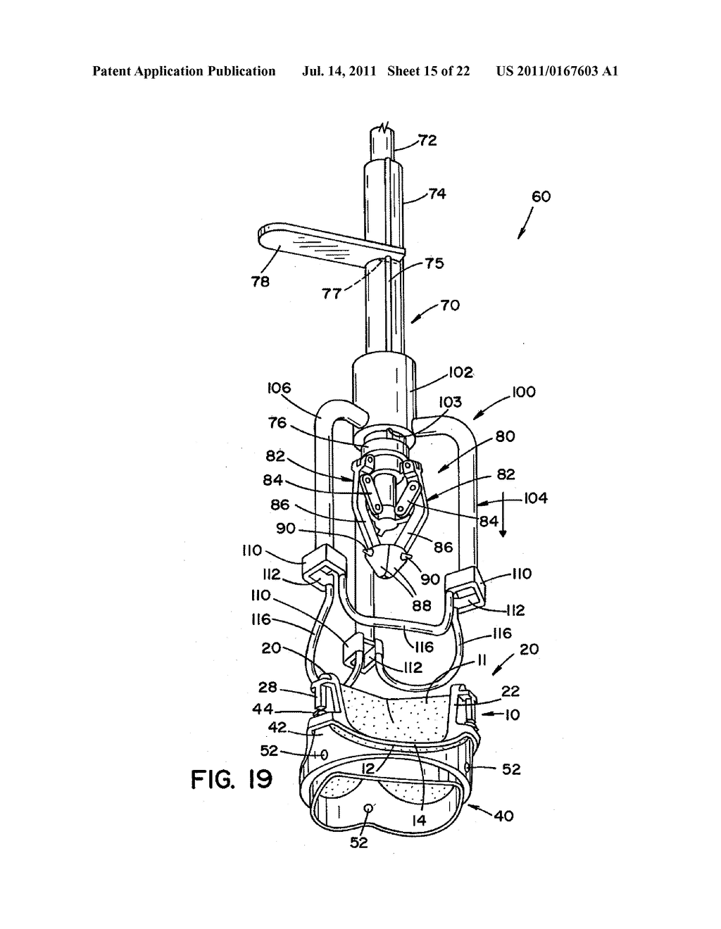 VALVE ASSEMBLY WITH EXCHANGEABLE VALVE MEMBER AND A TOOL SET FOR     EXCHANGING THE VALVE MEMBER - diagram, schematic, and image 16