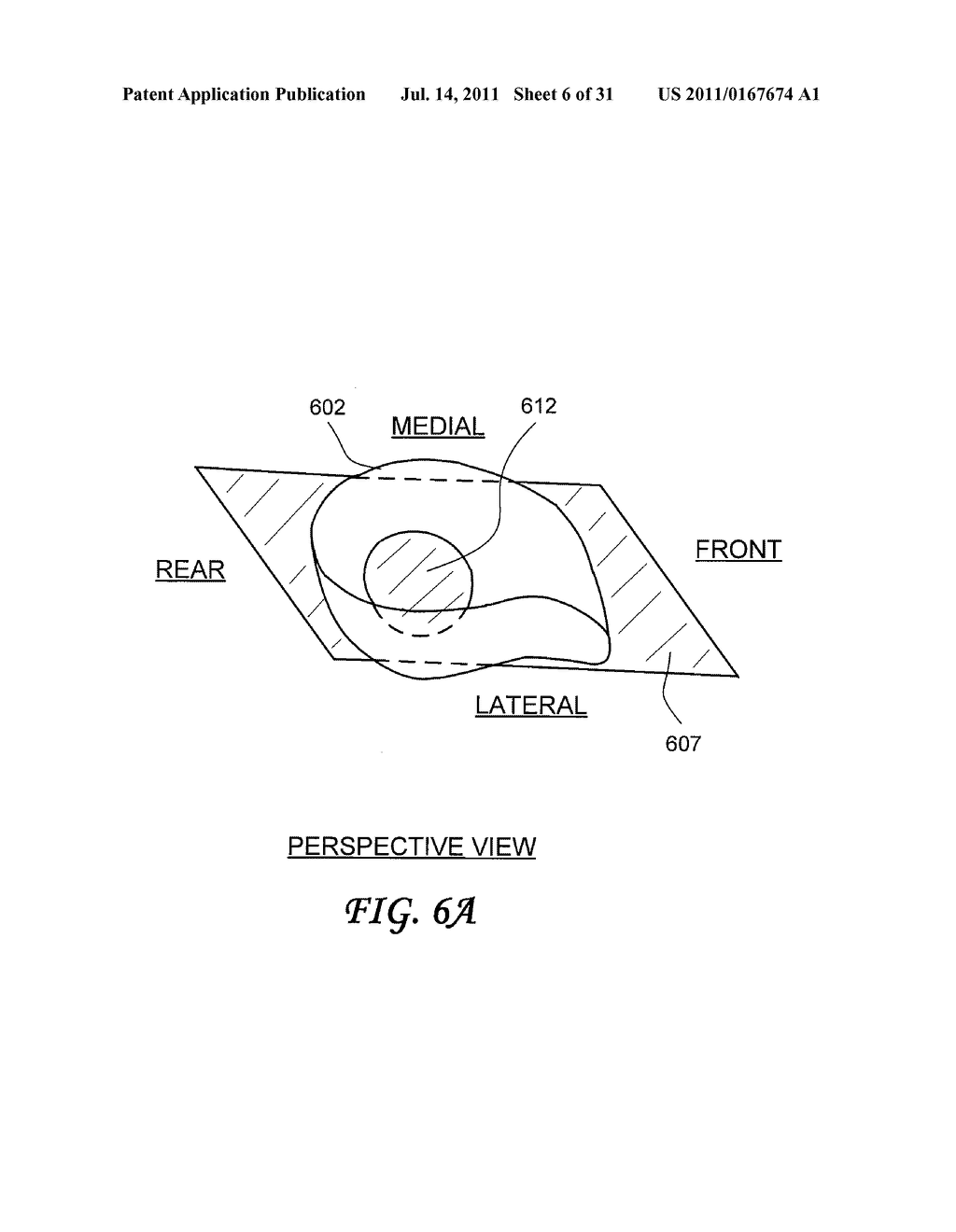 Rearfoot Post for Orthotics - diagram, schematic, and image 07