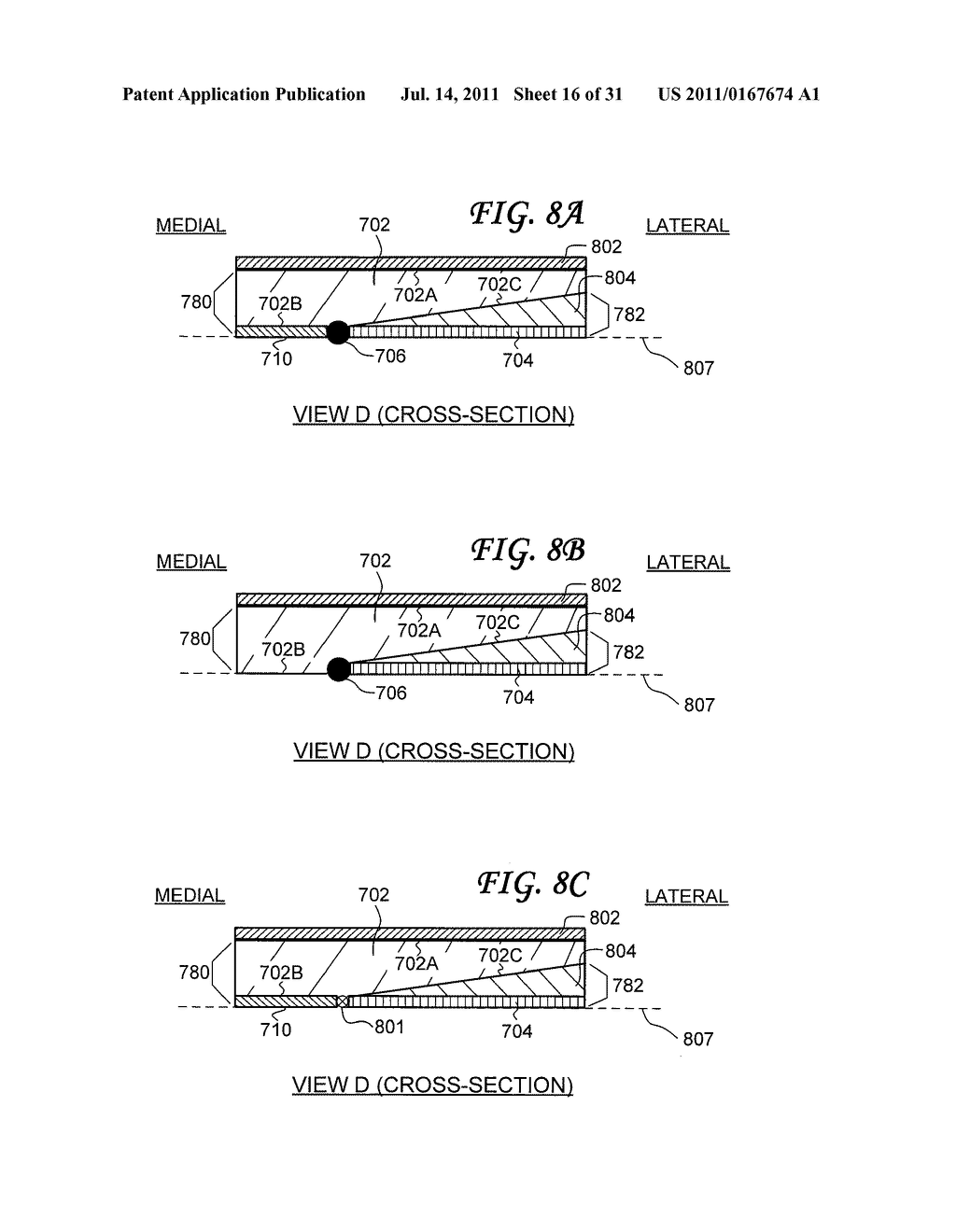 Rearfoot Post for Orthotics - diagram, schematic, and image 17