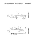 BIOMECHANICALLY DERIVED CRUTCH diagram and image