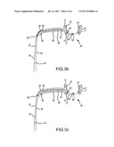 ASSEMBLY STRUCTURE FOR A LUGGAGE CASE diagram and image