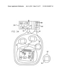 Low Frequency Inductive Tagging for Lifecycle Managment diagram and image