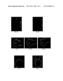 VEIN PATTERN RECOGNITION BASED BIOMETRIC SYSTEM AND METHODS THEREOF diagram and image