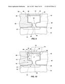 CAPACITOR-LESS MEMORY CELL, DEVICE, SYSTEM AND METHOD OF MAKING SAME diagram and image