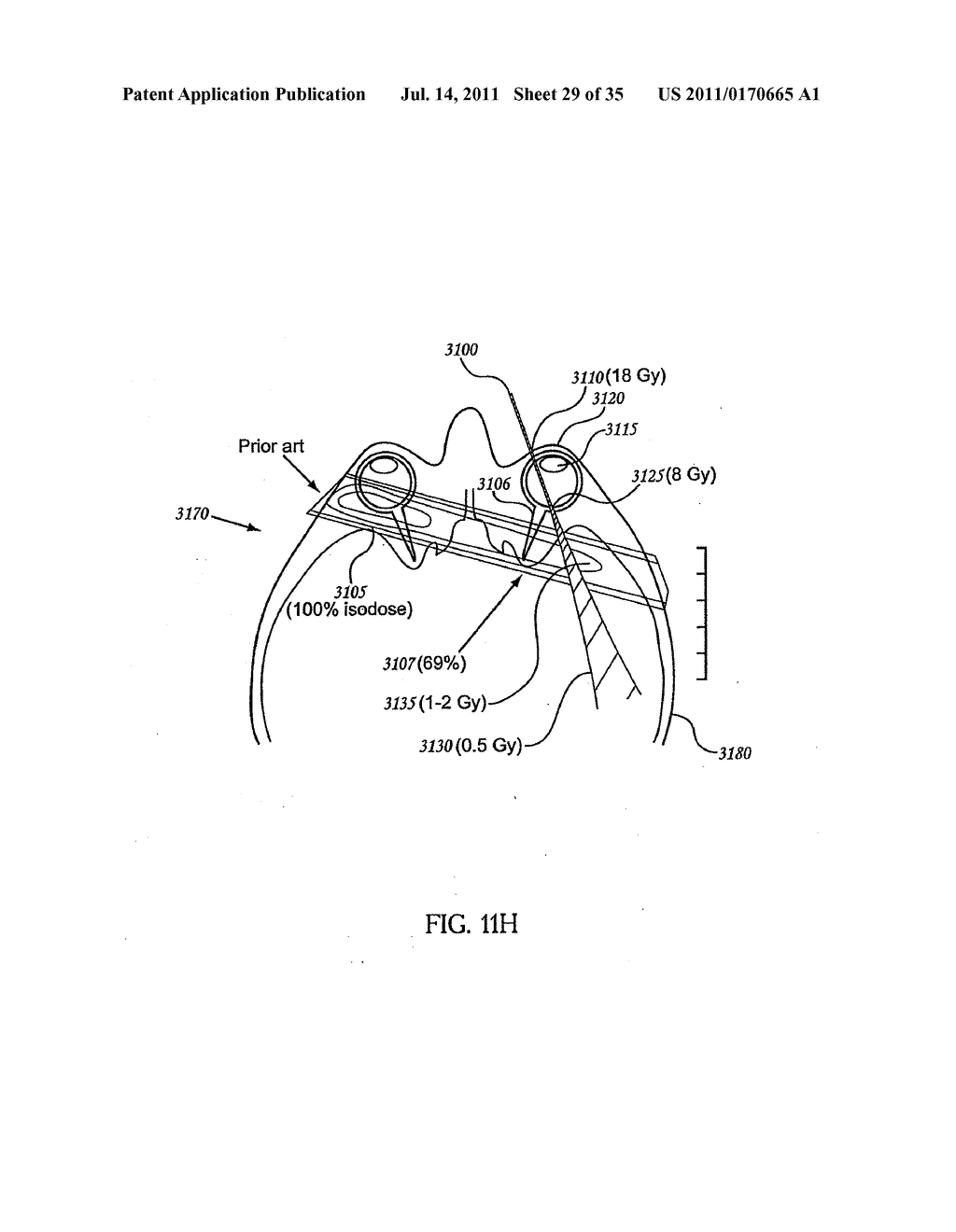 ORTHOVOLTAGE RADIOTHERAPY - diagram, schematic, and image 30