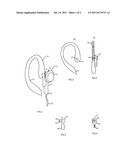 Earbud Stabilization System diagram and image