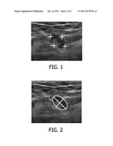 SELECTION OF SNAPSHOTS OF A MEDICAL IMAGE SEQUENCE diagram and image