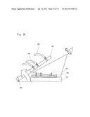 IMMOBILIZING DEVICE AND IMMOBILIZATION METHOD USING THE IMMOBILIZATION     DEVICE diagram and image