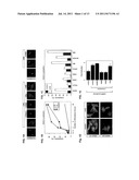 METHODS OF TREATMENT AND USES FOR CAMKII AND ITS INTERACTION WITH HDACS     AND CALPAIN diagram and image