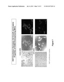 METHODS FOR TREATING NEOPLASTIC DISEASE TARGETING O-LINKED     N-ACETYLGLUCOSAMINE MODIFICATIONS OF CELLULAR PROTEIN diagram and image