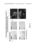 METHODS FOR TREATING NEOPLASTIC DISEASE TARGETING O-LINKED     N-ACETYLGLUCOSAMINE MODIFICATIONS OF CELLULAR PROTEIN diagram and image