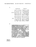 COMPOSITIONS AND METHODS FOR THE TREATMENT OF A NEOPLASIA diagram and image