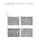 USE OF CCR9, CCL25/TECK, AND INTEGRIN ALPHA4 IN DIAGNOSIS AND TREATMENT OF     MELANOMA METASTASIS IN THE SMALL INTESTINE diagram and image