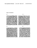 USE OF CCR9, CCL25/TECK, AND INTEGRIN ALPHA4 IN DIAGNOSIS AND TREATMENT OF     MELANOMA METASTASIS IN THE SMALL INTESTINE diagram and image