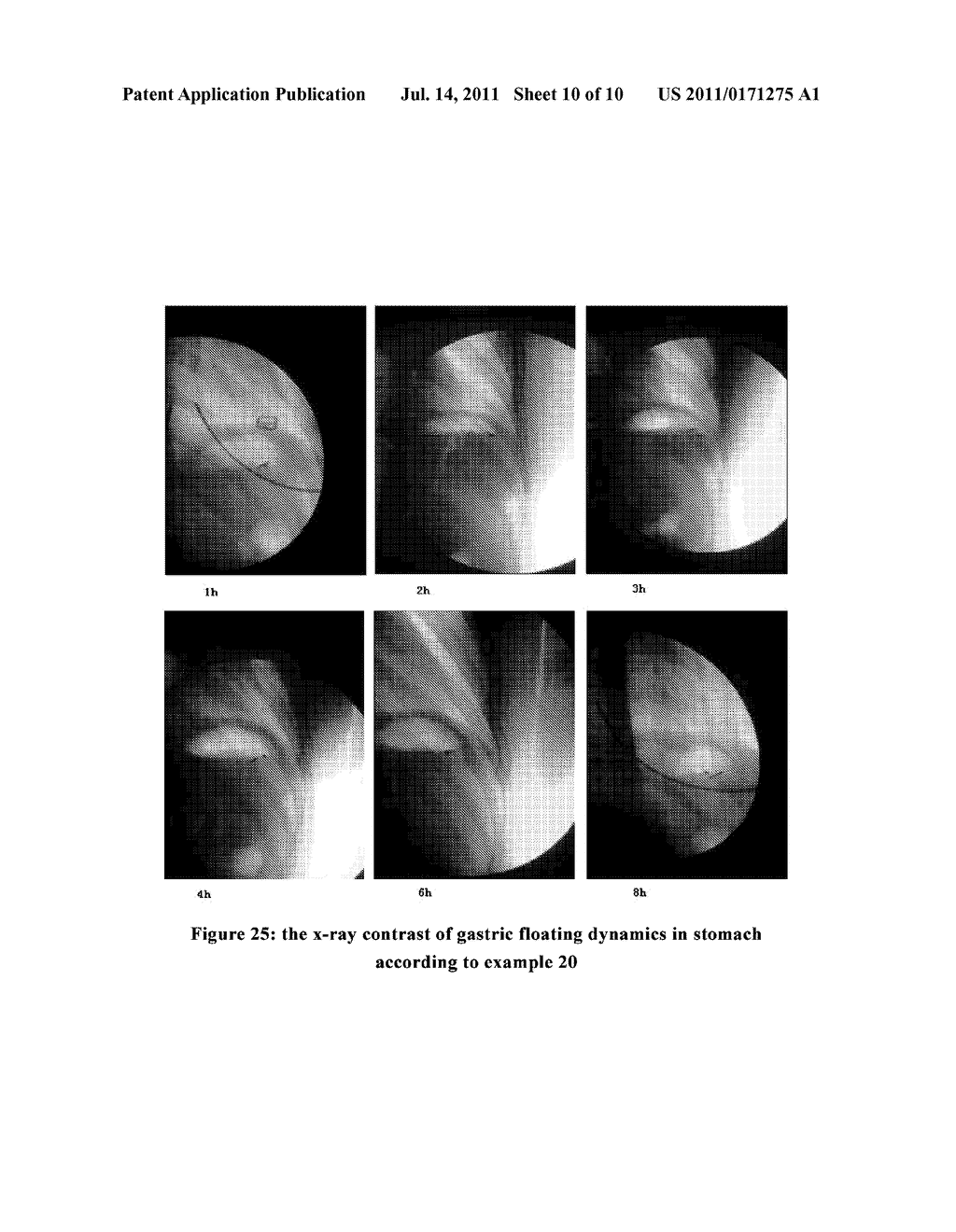 GASTRORETENTIVE DRUG DELIVERY SYSTEM, PREPARATION METHOD AND USE THEREOF - diagram, schematic, and image 11