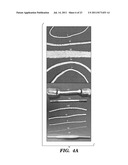 IMMUNONEUTRAL SILK-FIBER-BASED MEDICAL DEVICES diagram and image