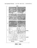 IMMUNONEUTRAL SILK-FIBER-BASED MEDICAL DEVICES diagram and image