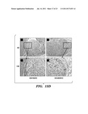 IMMUNONEUTRAL SILK-FIBER-BASED MEDICAL DEVICES diagram and image