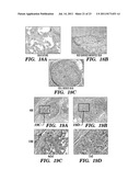 IMMUNONEUTRAL SILK-FIBER-BASED MEDICAL DEVICES diagram and image