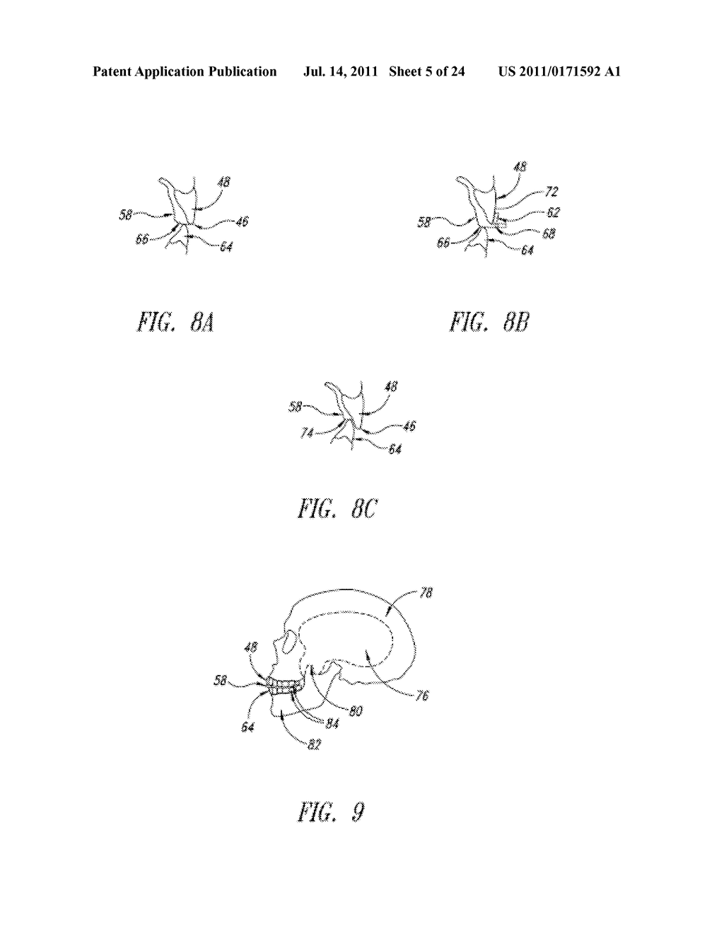 Method of Direct Fabrication of Intraoral Devices - diagram, schematic, and image 06