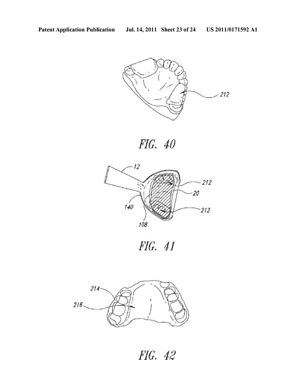 Method of Direct Fabrication of Intraoral Devices - diagram, schematic, and image 24