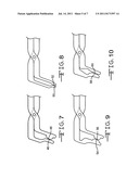 Method for in-situ simultaneous shaping of adjacent matrix bands and tools diagram and image