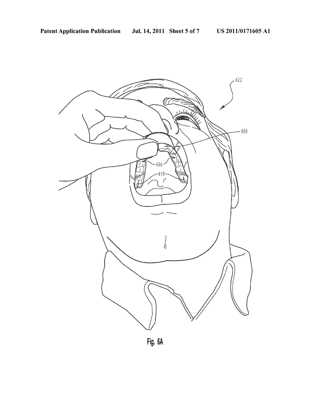 DENTAL TREATMENT DEVICES - diagram, schematic, and image 06