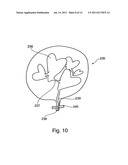 Balloon diagram and image