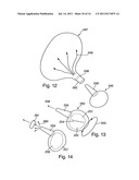 Balloon diagram and image